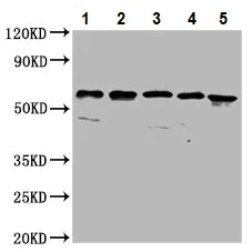 Western blot - Anti-CLCC1 antibody (AB237755)