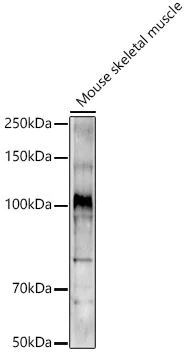 Western blot - Anti-CLCN1 antibody - C-terminal (AB189857)