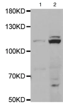 Western blot - Anti-CLCN1 antibody - C-terminal (AB189857)