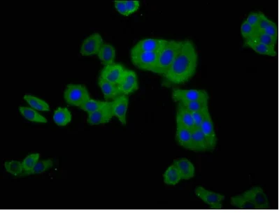 Immunocytochemistry/ Immunofluorescence - Anti-CLCNKB antibody (AB236733)