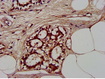 Immunohistochemistry (Formalin/PFA-fixed paraffin-embedded sections) - Anti-CLCNKB antibody (AB236733)