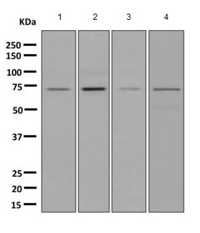 Western blot - Anti-CLCNKB antibody [EPR8414(2)] (AB167158)