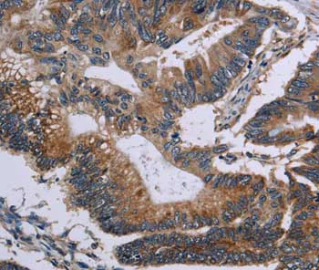 Immunohistochemistry (Formalin/PFA-fixed paraffin-embedded sections) - Anti-CLDND1 antibody (AB197340)
