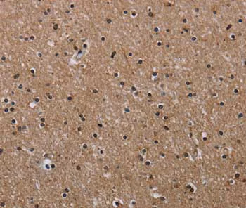 Immunohistochemistry (Formalin/PFA-fixed paraffin-embedded sections) - Anti-CLDND1 antibody (AB197340)