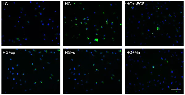 Immunocytochemistry/ Immunofluorescence - Anti-Cleaved Caspase-3 antibody [E83-77] (AB32042)