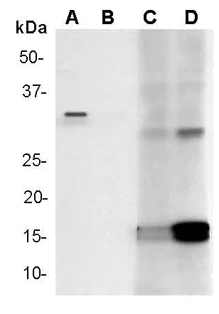 Western blot - Anti-Cleaved Caspase-3 antibody [E83-77] (AB32042)
