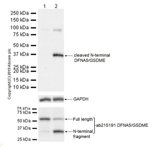 Western blot - Anti-cleaved N-terminal DFNA5 / GSDME antibody [EPR20866-160] - BSA and Azide free (AB256122)