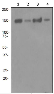 Western blot - Anti-Cleaved NEAS (Asp1185) antibody [EPR3830-17] (AB92373), expandable thumbnail