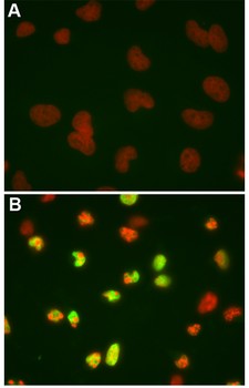 Immunocytochemistry/ Immunofluorescence - Anti-Cleaved PARP1 antibody [4B5BD2] (AB110315), expandable thumbnail