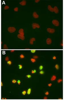 Immunocytochemistry/ Immunofluorescence - Anti-Cleaved PARP1 antibody [4B5BD2] (AB110315)