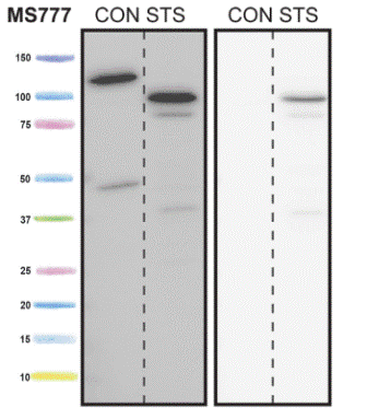 Western blot - Anti-Cleaved PARP1 antibody [4B5BD2] (AB110315), expandable thumbnail