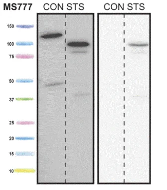 Western blot - Anti-Cleaved PARP1 antibody [4B5BD2] (AB110315)