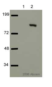 Western blot - Anti-Cleaved PARP1 antibody (AB4830)