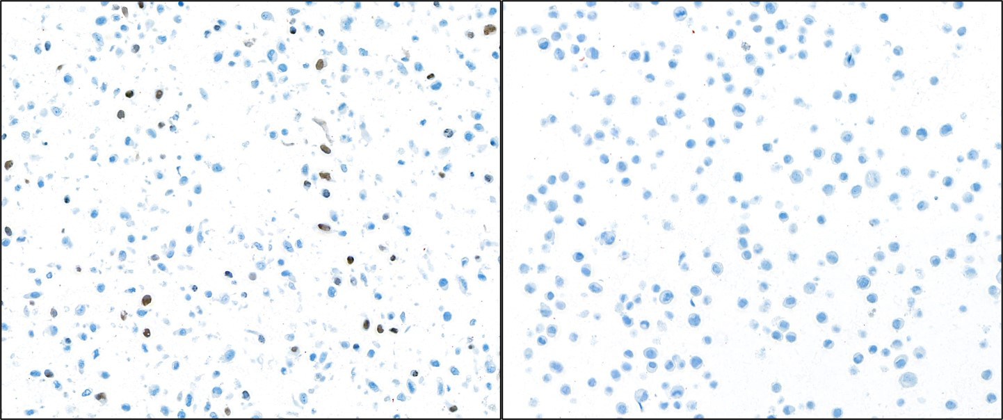 Immunocytochemistry - Anti-Cleaved PARP1 antibody [BLR183J] - BSA free (AB314102), expandable thumbnail