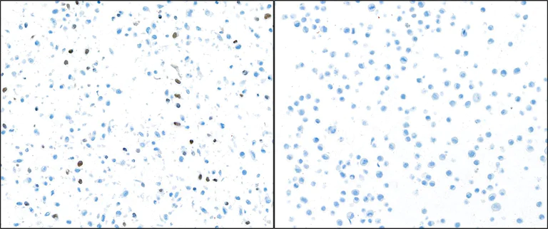 Immunocytochemistry - Anti-Cleaved PARP1 antibody [BLR183J] - BSA free (AB314102)