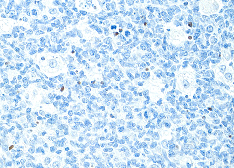 Immunohistochemistry (Formalin/PFA-fixed paraffin-embedded sections) - Anti-Cleaved PARP1 antibody [BLR183J] - BSA free (AB314102), expandable thumbnail