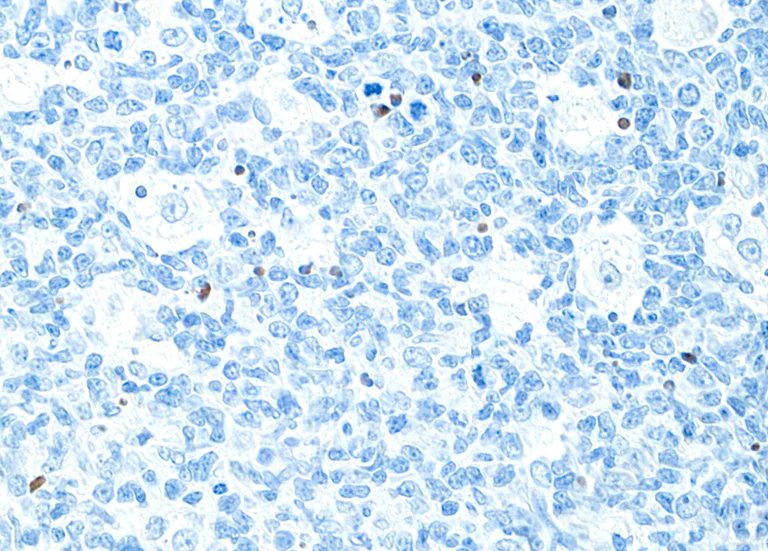Immunohistochemistry (Formalin/PFA-fixed paraffin-embedded sections) - Anti-Cleaved PARP1 antibody [BLR183J] - BSA free (AB314102)