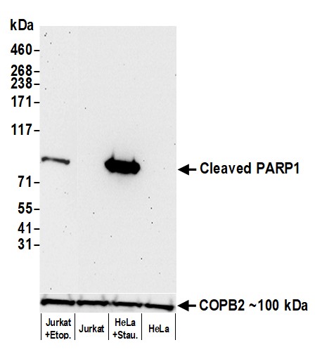 Western blot - Anti-Cleaved PARP1 antibody [BLR183J] - BSA free (AB314102), expandable thumbnail