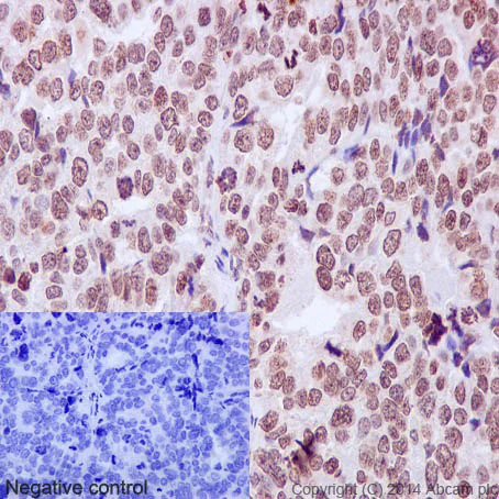 Immunohistochemistry (Formalin/PFA-fixed paraffin-embedded sections) - Anti-Cleaved PARP1 antibody [E51] (AB32064)