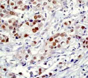 Immunohistochemistry (Formalin/PFA-fixed paraffin-embedded sections) - Anti-Cleaved PARP1 antibody [E51] (AB32064)