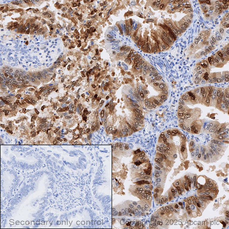Immunohistochemistry (Formalin/PFA-fixed paraffin-embedded sections) - Anti-Cleaved PARP1 antibody [E51] (AB32064)