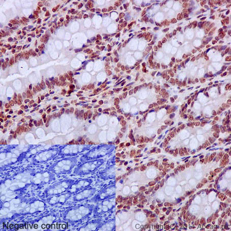 Immunohistochemistry (Formalin/PFA-fixed paraffin-embedded sections) - Anti-Cleaved PARP1 antibody [E51] (AB32064)