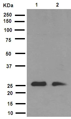 Western blot - Anti-Cleaved PARP1 antibody [E51] (AB32064)