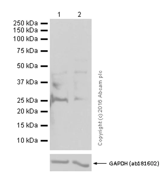 Western blot - Anti-Cleaved PARP1 antibody [E51] (AB32064)