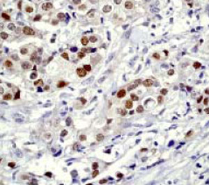 Immunohistochemistry (Formalin/PFA-fixed paraffin-embedded sections) - Anti-Cleaved PARP1 antibody [E51] - BSA and Azide free (AB203467)