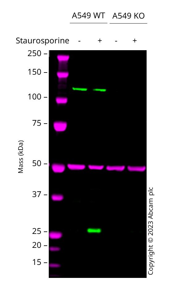 Western blot - Anti-Cleaved PARP1 antibody [SP276] (AB225715), expandable thumbnail