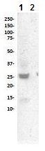 Western blot - Anti-Cleaved PARP1 antibody [SP276] (AB225715), expandable thumbnail
