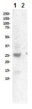 Western blot - Anti-Cleaved PARP1 antibody [SP276] (AB225715)