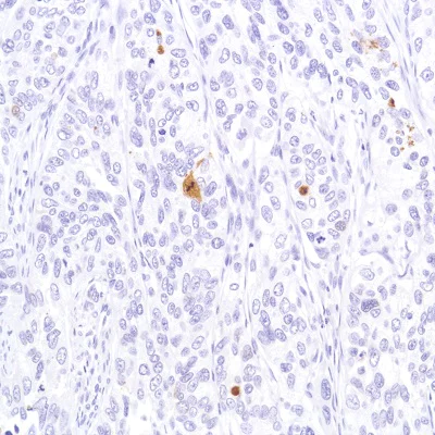 Immunohistochemistry (Formalin/PFA-fixed paraffin-embedded sections) - Anti-Cleaved PARP1 antibody [SP276] - BSA and Azide free (AB272005)