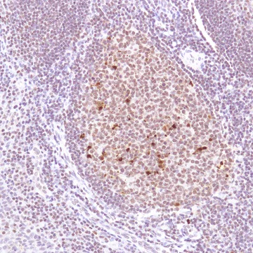 Immunohistochemistry (Formalin/PFA-fixed paraffin-embedded sections) - Anti-Cleaved PARP1 antibody [SP276] - BSA and Azide free (AB272005)