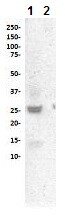 Western blot - Anti-Cleaved PARP1 antibody [SP276] - BSA and Azide free (AB272005), expandable thumbnail