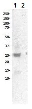 Western blot - Anti-Cleaved PARP1 antibody [SP276] - BSA and Azide free (AB272005)