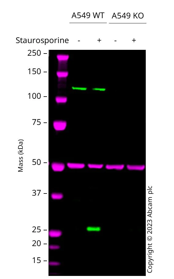 Western blot - Anti-Cleaved PARP1 antibody [SP276] - BSA and Azide free (AB272005)