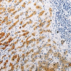 Immunohistochemistry (Formalin/PFA-fixed paraffin-embedded sections) - Anti-CLEC-2 antibody (AB197349), expandable thumbnail