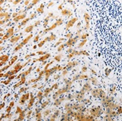 Immunohistochemistry (Formalin/PFA-fixed paraffin-embedded sections) - Anti-CLEC-2 antibody (AB197349)