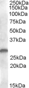 Western blot - Anti-CLEC-2 antibody (AB81983)