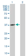 Western blot - Anti-CLEC10A antibody (AB168613)