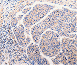 Immunohistochemistry (Formalin/PFA-fixed paraffin-embedded sections) - Anti-CLEC10A antibody (AB197346)