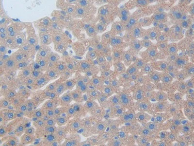 Immunohistochemistry (Formalin/PFA-fixed paraffin-embedded sections) - Anti-CLEC10A antibody (AB232683)