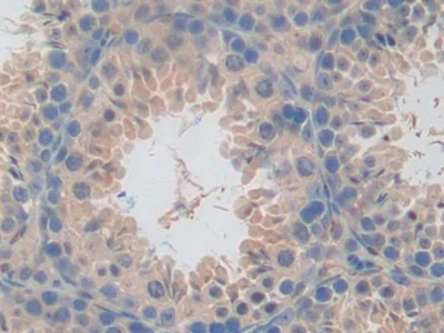 Immunohistochemistry (Formalin/PFA-fixed paraffin-embedded sections) - Anti-CLEC10A antibody (AB232683)