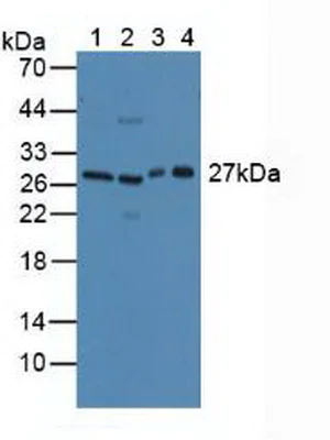 Western blot - Anti-CLEC10A antibody (AB232683)