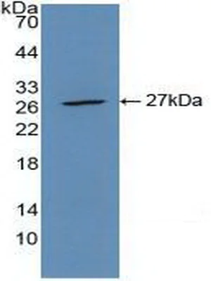 Western blot - Anti-CLEC10A antibody (AB232683)
