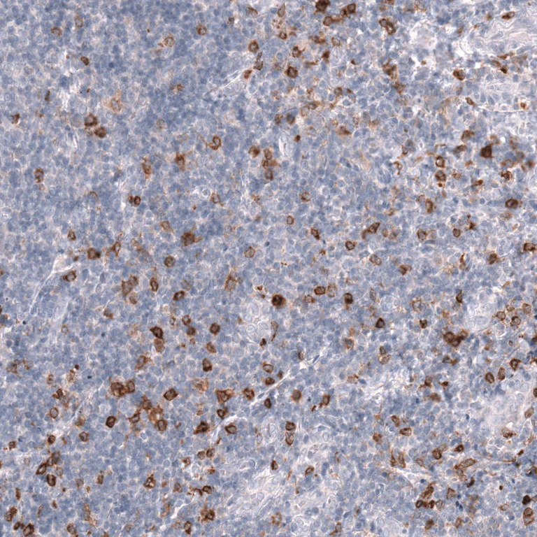 Immunohistochemistry (Formalin/PFA-fixed paraffin-embedded sections) - Anti-CLEC10A Antibody [CL15513] (AB327163)