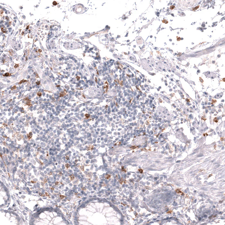 Immunohistochemistry (Formalin/PFA-fixed paraffin-embedded sections) - Anti-CLEC10A Antibody [CL15513] (AB327163)