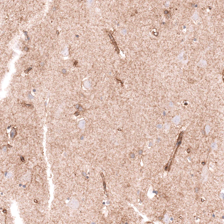 Immunohistochemistry (Formalin/PFA-fixed paraffin-embedded sections) - Anti-CLEC10A Antibody [CL15513] (AB327163)