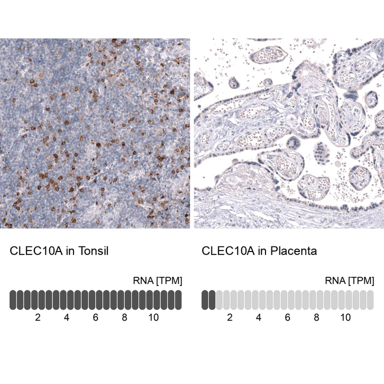 Immunohistochemistry (Formalin/PFA-fixed paraffin-embedded sections) - Anti-CLEC10A Antibody [CL15513] (AB327163)